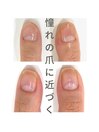 最強ネイルケア