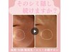 ★1１月継続【本気でシミ撲滅したい方】シミケア90分¥27500→¥19250美容液付