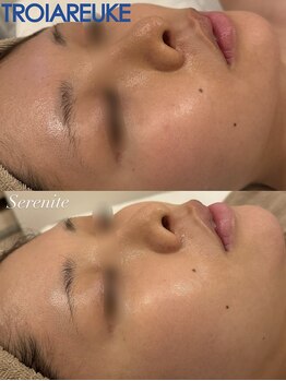 セレニテ(Serenite)/