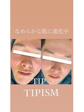 ニコサロン(nico salon)/ニキビケア/毛穴改善/肌質改善◎