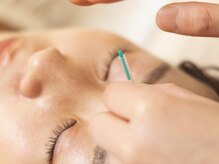 武蔵小杉鍼灸接骨院/眼精疲労をスッキリ改善