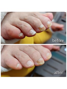 爪切り屋 足楽/