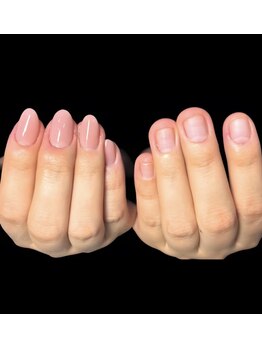 ラピシア(Rapicia)/