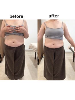 ジョワイユ(Joyeux)/腸の位置でお腹は変わる