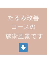 経堂鍼灸整体院/たるみ改善コースの施術の流れ