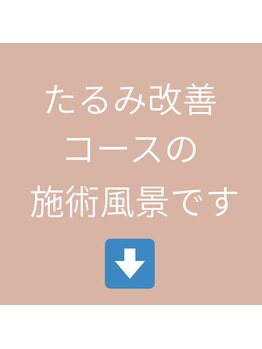 経堂鍼灸整体院/たるみ改善コースの施術の流れ