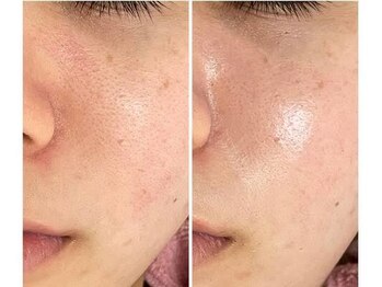 スリリアン 銀座/★お客さまビフォーアフター