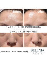 セレニア ボーテ(Selenia Beaute)/