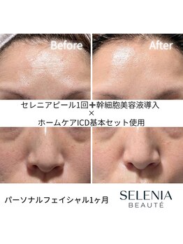 セレニア ボーテ(Selenia Beaute)/