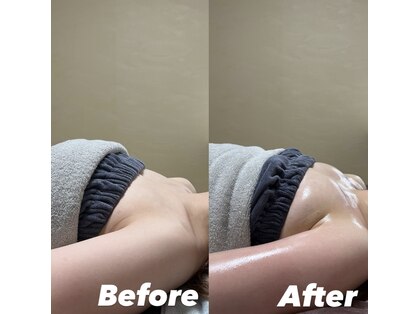 オンユ(Onyu)の写真