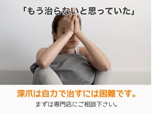 レアム/伸びてもまた噛んでしまう。