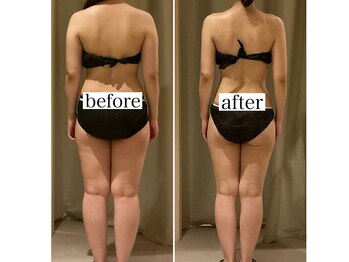 ドゥ ボーテ(de beaute)の写真/結婚式へ向けて輝く私に☆脂肪分解ケアで効果かんじる、理想のボディラインをサポート！◎