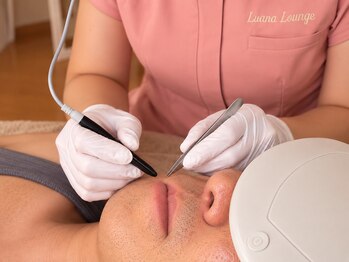 ルアナラウンジ(Luana Lounge)の写真/【何年脱毛しても残る毛・白髪に】美容電気脱毛で1本ずつ丁寧にアプローチ◎
