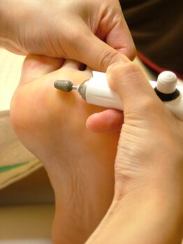 ボヌール(Bonheur)/角質ケア