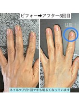 桃の木 吉祥寺店/月1のペースで爪育されています