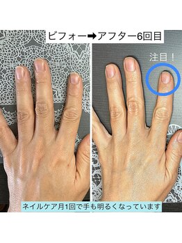 桃の木 吉祥寺店/月1のペースで爪育されています