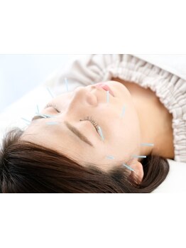 鍼灸施術を受けたい