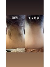 リネン(Lien)/脱毛長持ちwax