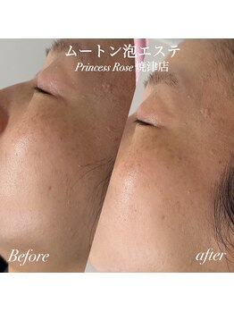 プリンセスローズ 焼津店(Princess Rose)/ムートン泡エステ