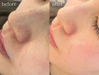 テオリア(TEORIA)/