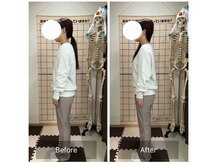 コアスタイル(Core×Style)/【猫背矯正】Before → After