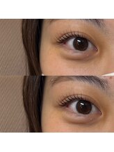 フィービー(pheebe)/ラッシュリフト