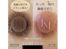 ハスパリ あけぼの町(HASPALI)の雰囲気（【韓国最新美容】ルメラ導入店）
