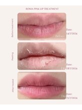 ツキ(TSUKI)/ローマピンク