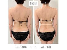 ビューイング(美ing)の雰囲気（1回で実感！肩まわり＆背中すっきり、後ろ姿まで印象が変わる。）