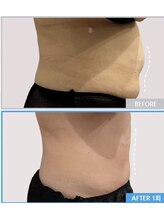 美と健康と痩身サロン マリアローズ(Maria Rose)/たった20分で驚きの効果効果