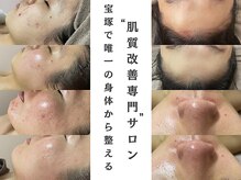 ミロン(miron)