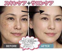 ヴィーナスハンド