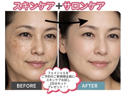 ヴィーナスハンドの写真