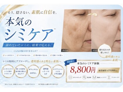 ルナ(Luna)の写真