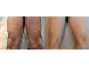 ラグジー 本八幡店(LUXY)/全身の脱毛に対応してます