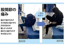 セルフケア整体 新宿店/実際のお客様◆1来店　股関節