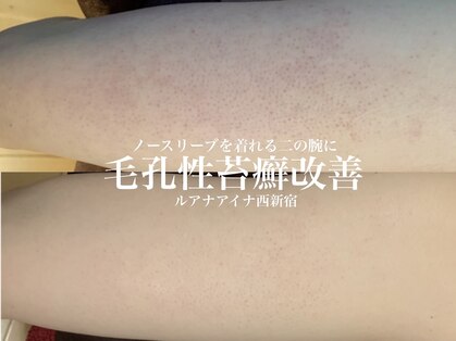 ルアナアイナ(Luana Aina)の写真