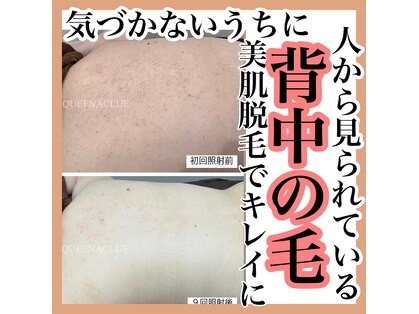 クイーナクルー(QUEENA CLUE)の写真