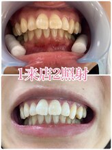 ラブホワイトニング 銀座店(LOVEホワイトニング)/＃ホワイトニング