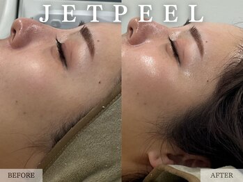 レヴェリー 心斎橋店(REVERIE)/‐ JETPEEL ‐