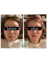 キュープ 浜松店(Qpu)/余白を無くし一回り小さいお顔に