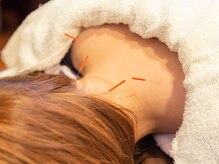 えんどう鍼灸接骨院/眼精疲労/自律神経/不眠/