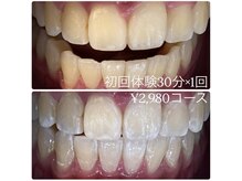 ホワイトニングルーム 横浜店(Whitening Room)/セルフホワイトニング/横浜