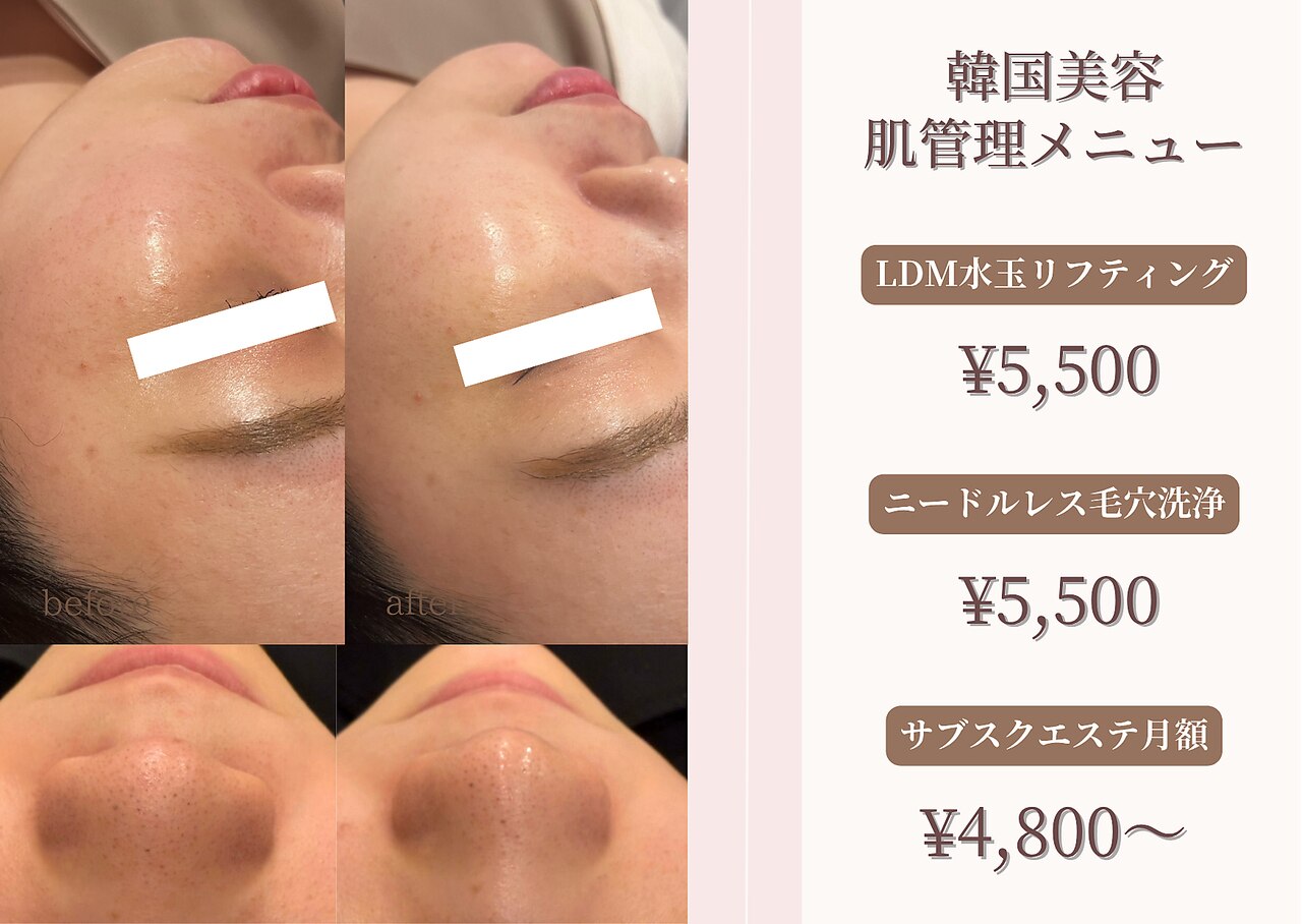 水玉リフティング 大阪に関するエステサロン 艶肌 国産ハーブ