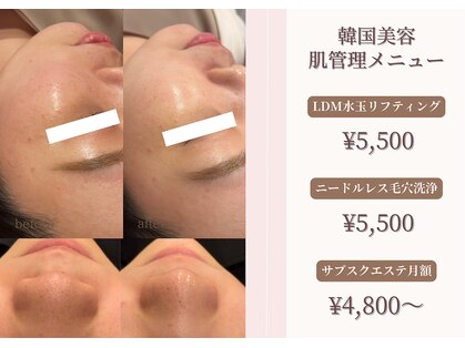 ミアンカ(mianca)の写真