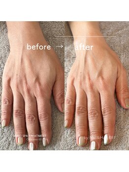 ゼロハチイチ(081)/Hand Spa Treatment