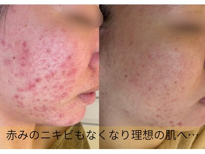 ポアレ(POARE)の写真