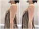 美極 トータルビューティー(美極 TOTAL BEAUTY)の写真/ぽよ肉&セル脂肪一掃!!【ハイパーナイフ+リンパマッサージ90分】¥12800気になる二の腕、足を徹底ケア★