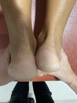 ビーチェック 長久手店(B-Check)/骨盤が歪むと、、、