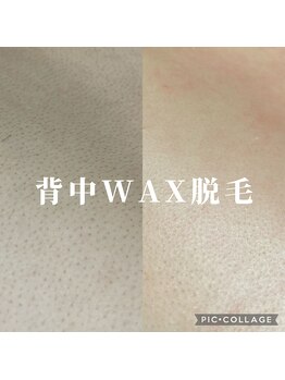 リモナ(Re-mona..)/ボディーのワックス脱毛も可能◎